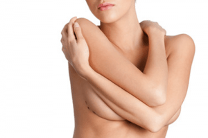 woman with breast revision