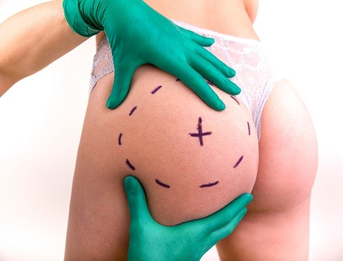 1764873882_d6621ca849904b1fbffb29eb6b33ff15