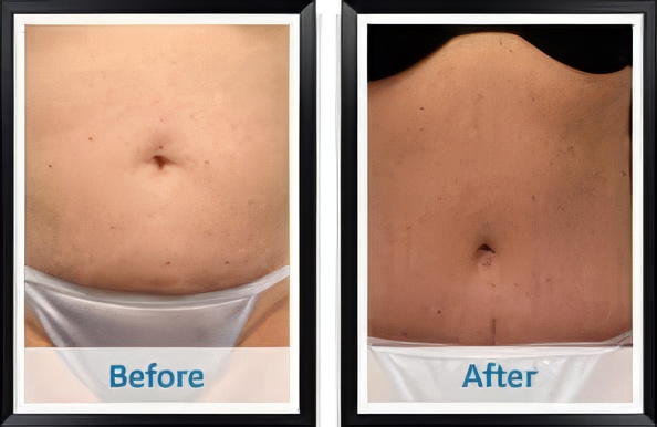 1764873652_8c2a9b679583454cb41179ba88e30539-1-topaz-upscale-2x