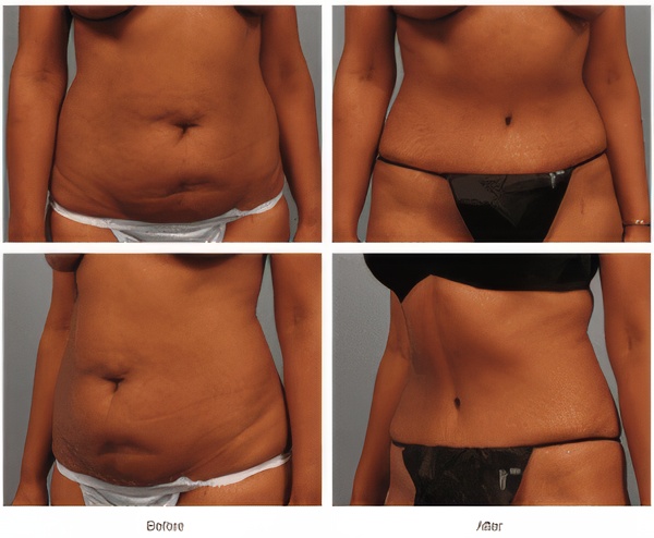 1764873681_71aee74d7586402997452db3ea71f33a-1-topaz-upscale-2x