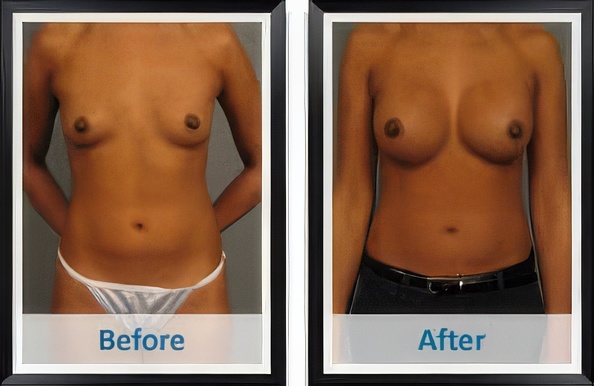 1764873790_877def3532e441b49dd8422c90c253fb-1-topaz-text-upscale-2x