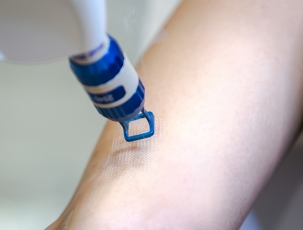 scar-topaz-upscale-2x